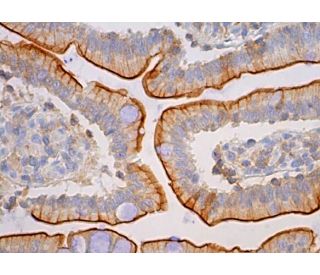 LMO7 Antibody (B-7) - Immunohistochemistry - Image 380142 