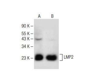 western blotting image from recommended LMP2 (G-3) monoclonal antibody replacement. Image 147771