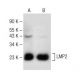 This polyclonal antibody has been discontinued. See our recommended <a href="lmp2-antibody-g-3">LMP2 (G-3)</a> monoclonal antibody (sample data shown). western blotting image from recommended LMP2 (G-3) monoclonal antibody replacement. Image 147771