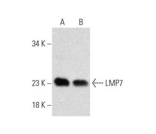 LMP7 Antibody (56-T) - Western Blotting - Image 136296 