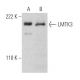 LMTK3 Antibody (I-17) - Western Blotting - Image 368567 