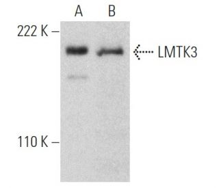 LMTK3 Antibody (I-17) - Western Blotting - Image 368567Each CRISPR/Cas9 Knockout (KO) Plasmid product consists of a pool of 3 plasmids designed to ensure identification and cleavage of a specific gene for maximum knockout efficiency. Each plasmid encodes a unique 20 nt sequence derived from the GeCKO (v2) library. 