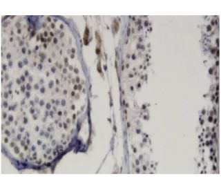 LMX1B Antibody (1D12) - Immunohistochemistry - Image 346120 