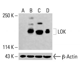 LOK Antibody (D-6) - Western Blotting - Image 415349Each CRISPR/Cas9 Knockout (KO) Plasmid product consists of a pool of 3 plasmids designed to ensure identification and cleavage of a specific gene for maximum knockout efficiency. Each plasmid encodes a unique 20 nt sequence derived from the GeCKO (v2) library.