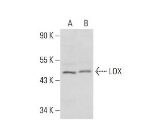 western blotting image from recommended LOX (F-8) monoclonal antibody replacement. Image 306202