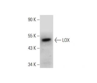 LOX Antibody (B-11) - Western Blotting - Image 331207Each CRISPR/Cas9 Knockout (KO) Plasmid product consists of a pool of 3 plasmids designed to ensure identification and cleavage of a specific gene for maximum knockout efficiency. Each plasmid encodes a unique 20 nt sequence derived from the GeCKO (v2) library. 