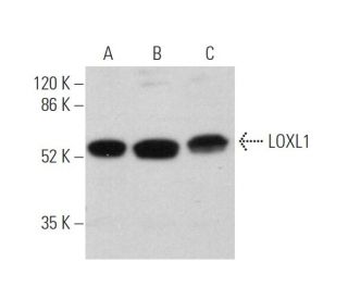 western blotting image from recommended LOXL1 (H-11) monoclonal antibody replacement. Image 374379