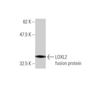 LOXL2 Antibody (3C5) - Western Blotting - Image 348537 