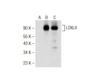 LOXL4 Antibody (D-11) - Western Blotting - Image 148797 