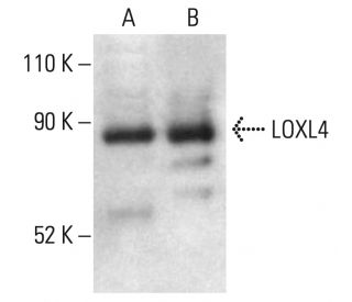 LOXL4 Antibody (B-6) - Western Blotting - Image 402311