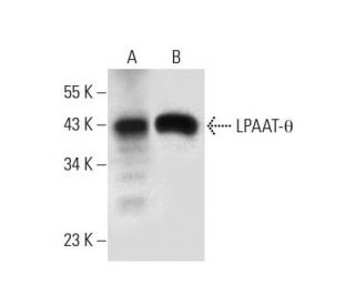 LPAAT-&theta; Antibody (G-3) - Western Blotting - Image 317962 