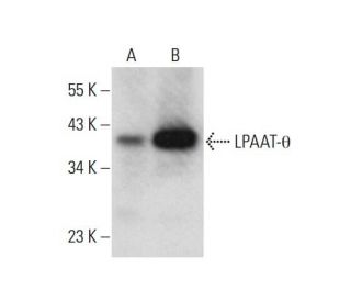 western blotting image from recommended LPAAT-&theta; (F-7) monoclonal antibody replacement. Image 317961