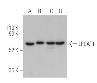 LPCAT1 Antibody (F-9) - Western Blotting - Image 400554The Double Nickase Plasmid features a U6 promoter for sgRNA expression, a 20 nt targeting sequence, and a gRNA scaffold to guide Cas9n. It includes a CBh promoter for Cas9n (D10A) and puromycin resistance, GFP for transfection verification, and nuclear localization signals (NLS). The 2A peptide allows co-expression of Cas9n and Puro from a single promoter, enabling precise genome editing with reduced off-target effects.