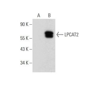 LPCAT2 Antibody (H-7) - Western Blotting - Image 318546