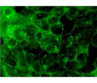 LPL Antibody (5D2) - Immunofluorescence - Image 145262