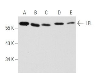 LPL Antibody (F-1) - Western Blotting - Image 354720 