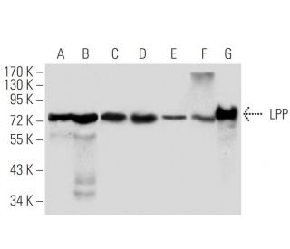 LPP Antibody (8B3A11) - Western Blotting - Image 137460 