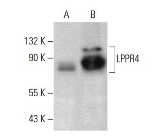 LPPR4 Antibody (E-5) - Western Blotting - Image 364836 