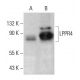 LPPR4 Antibody (E-5) - Western Blotting - Image 364836 