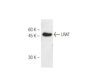 LRAT Antibody (M34-P1F10) - Western Blotting - Image 47838 