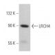 LRCH4 Antibody (F-12) - Western Blotting - Image 379405 