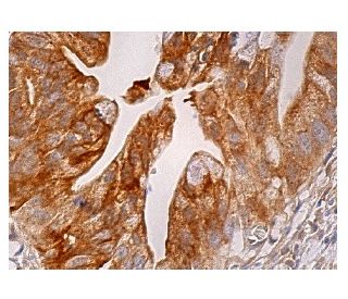 LRCH4 Antibody (H-10) - Immunohistochemistry - Image 159051 
