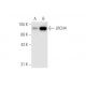 LRCH4 Antibody (H-10) - Western Blotting - Image 62644 