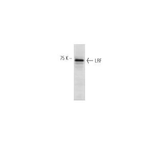LRF/Pokemon Antibody (13E9) - Western Blotting - Image 11504