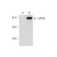 LRFN4 Antibody (F-3) - Western Blotting - Image 295795