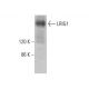 LRIG1 Antibody (B-2) - Western Blotting - Image 383993