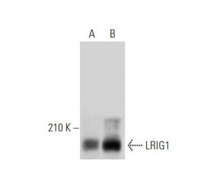 LRIG1 Antibody (B-2) - Western Blotting - Image 323827