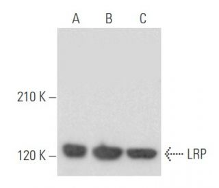 LRP Antibody (1014) - Western Blotting - Image 355570 