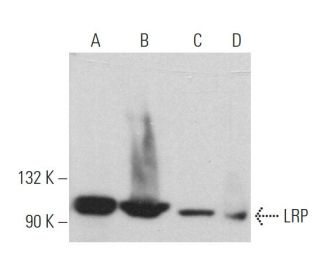 LRP Antibody (1032) - Western Blotting - Image 361863 