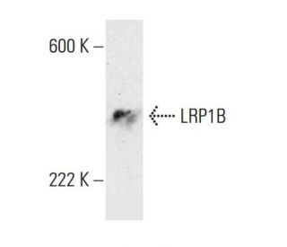 LRP1B Antibody (1642CT736.5.59) - Western Blotting - Image 384188