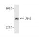 LRP1B Antibody (1642CT736.5.59) - Western Blotting - Image 384188