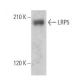 western blotting image from recommended LRP5 (B-9) monoclonal antibody replacement. Image 356317