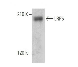 western blotting image from recommended LRP5 (B-9) monoclonal antibody replacement. Image 356317