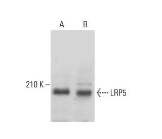 LRP5 Antibody (F-11) - Western Blotting - Image 379948