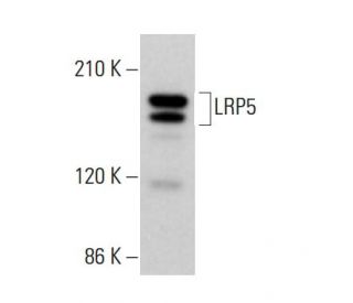 LRP5 Antibody (F-11) - Western Blotting - Image 379995The Double Nickase Plasmid features a U6 promoter for sgRNA expression, a 20 nt targeting sequence, and a gRNA scaffold to guide Cas9n. It includes a CBh promoter for Cas9n (D10A) and puromycin resistance, GFP for transfection verification, and nuclear localization signals (NLS). The 2A peptide allows co-expression of Cas9n and Puro from a single promoter, enabling precise genome editing with reduced off-target effects. 
