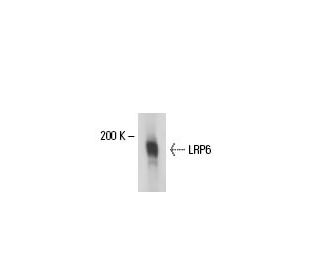 LRP6 Antibody (C-10) - Western Blotting - Image 17888