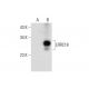 LRRC18 Antibody (D-2) - Western Blotting - Image 297077