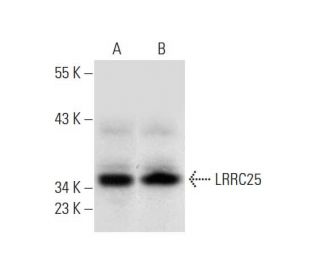 LRRC25 Antibody (E-7) - Western Blotting - Image 318375 