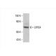 LRRC4 Antibody (C-11) - Western Blotting - Image 392570