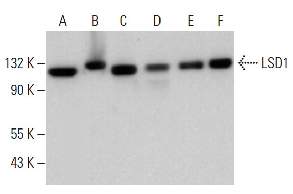 ソマリDGJW LSD1 Antibody (1B2E5) | SCBT - Santa Cruz Biotechnology
