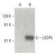 LSDP5 Antibody (E-3) - Western Blotting - Image 397525