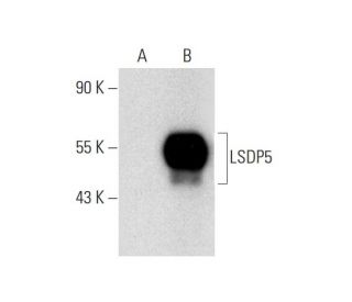 LSDP5 Antibody (E-3) - Western Blotting - Image 318526Each CRISPR/Cas9 Knockout (KO) Plasmid product consists of a pool of 3 plasmids designed to ensure identification and cleavage of a specific gene for maximum knockout efficiency. Each plasmid encodes a unique 20 nt sequence derived from the GeCKO (v2) library.