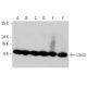 LSm2 Antibody (AT2B2) - Western Blotting - Image 385117 