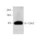 LSm2 Antibody (AT2B2) - Western Blotting - Image 385118