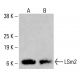 LSm2 Antibody (AT2B2) - Western Blotting - Image 416475 