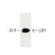 LSP1 Antibody (16) - Western Blotting - Image 60353 